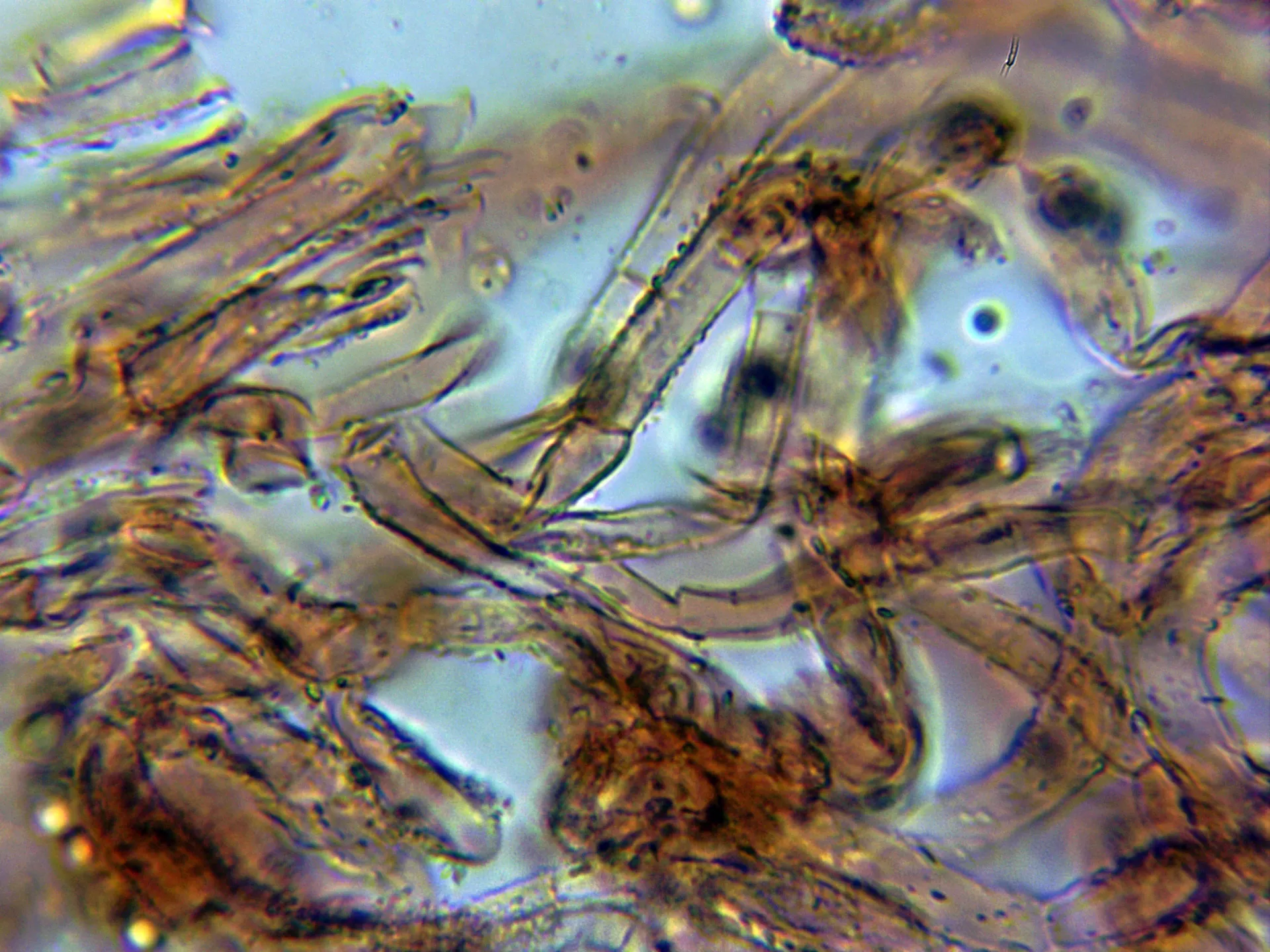 Microscopía de Tricholoma acerbum - 11 - Cutícula